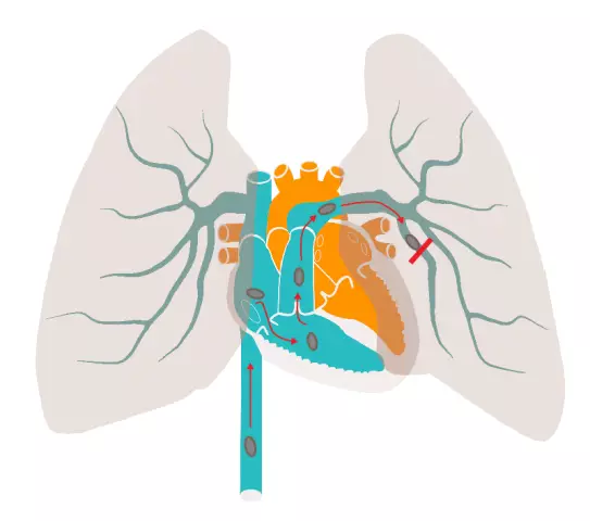 Leiud Koerte Pulmonaalse Hüpertensiooni Kohta